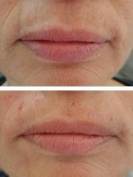 /album/fotogalerie/kh-pred-a-po-4-jpg/